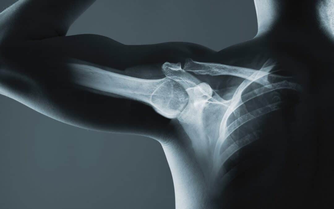 Formation continue : L’épaule et ses principales pathologies le 13 mars 2026